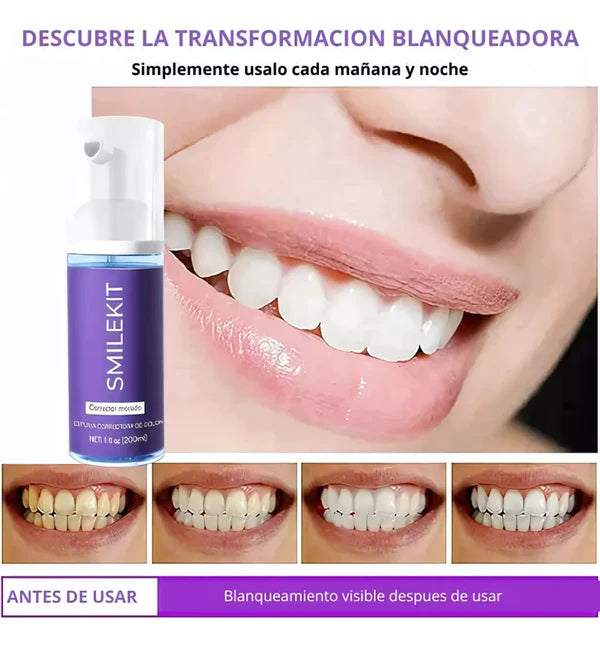 SMILEKIT®: ESPUMA MORADA BLANQUEADORA