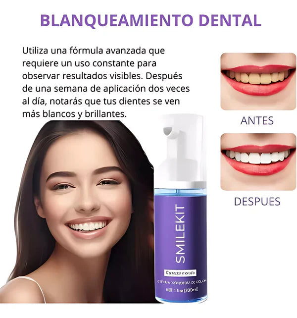 SMILEKIT®: ESPUMA MORADA BLANQUEADORA